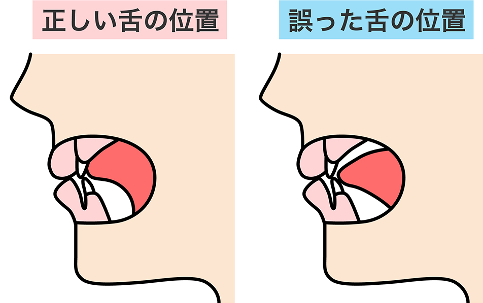 舌の位置の重要性